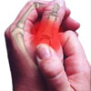 Joint Pain & Arthritis